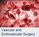 Vascular Surgery | Venous Disease, Stroke and More