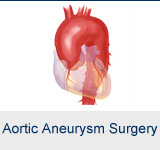 Aortic Aneurysm Surgery
